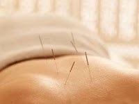 West Malling Acupuncture 726331 Image 1